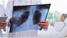 扳手腕输了事小 肱骨“折”了事大!