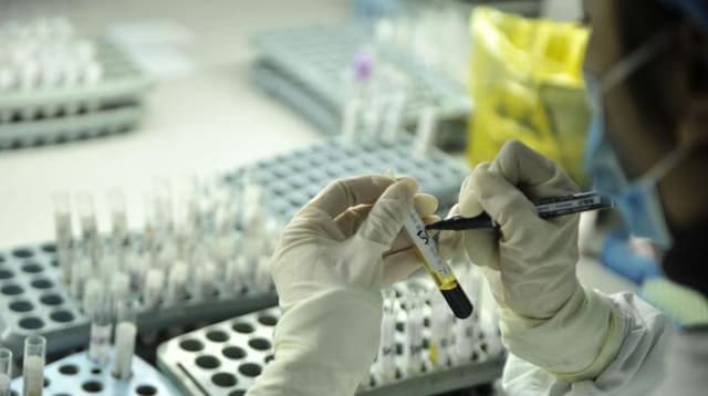 第36个“世界艾滋病日”,关于这些一定要知道